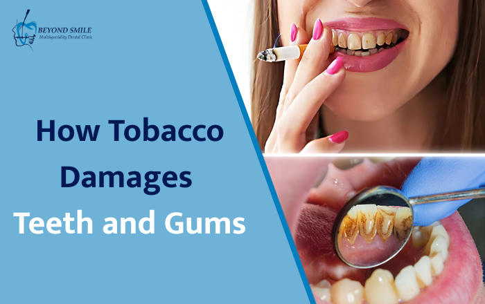 How Does Tobacco Affect Your Teeth and Gums?