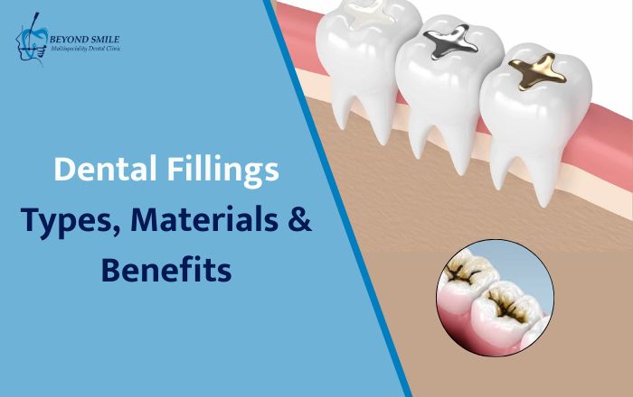 What Are Dental Fillings? Types, Materials & How They Protect Your Teeth