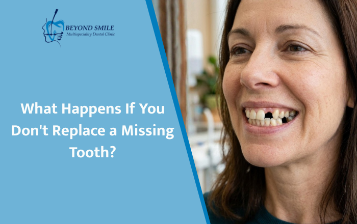 What Happens If You Don't Replace a Missing Tooth