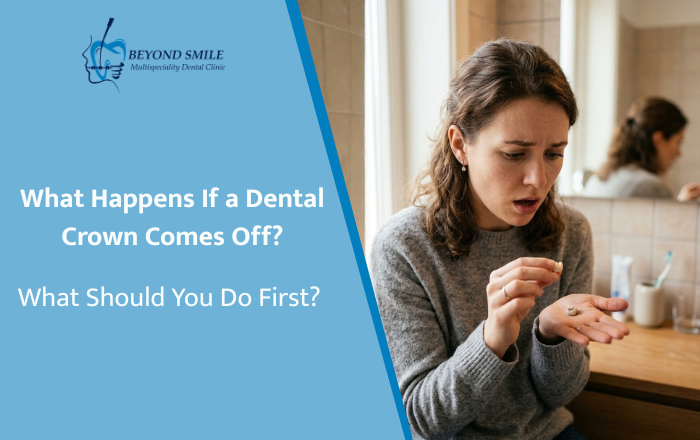 What Happens If a Dental Crown Comes Off? What Should You Do First?