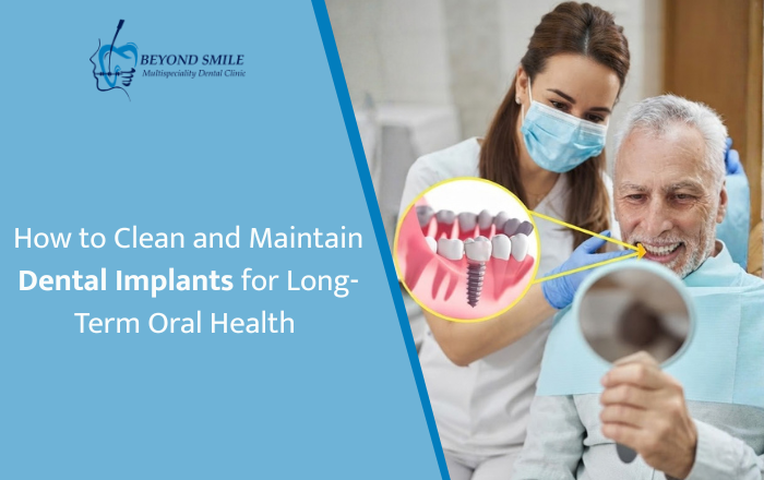 How to Clean and Maintain Dental Implants for Long-Term Oral Health